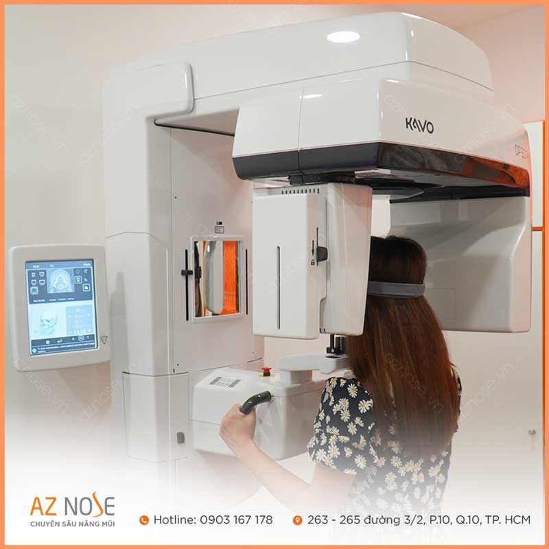 Chụp CT để kiểm tra tình trạng và cấu trúc mũi hiện tại ở AZ NOSE - phòng khám chuyên sâu nâng mũi