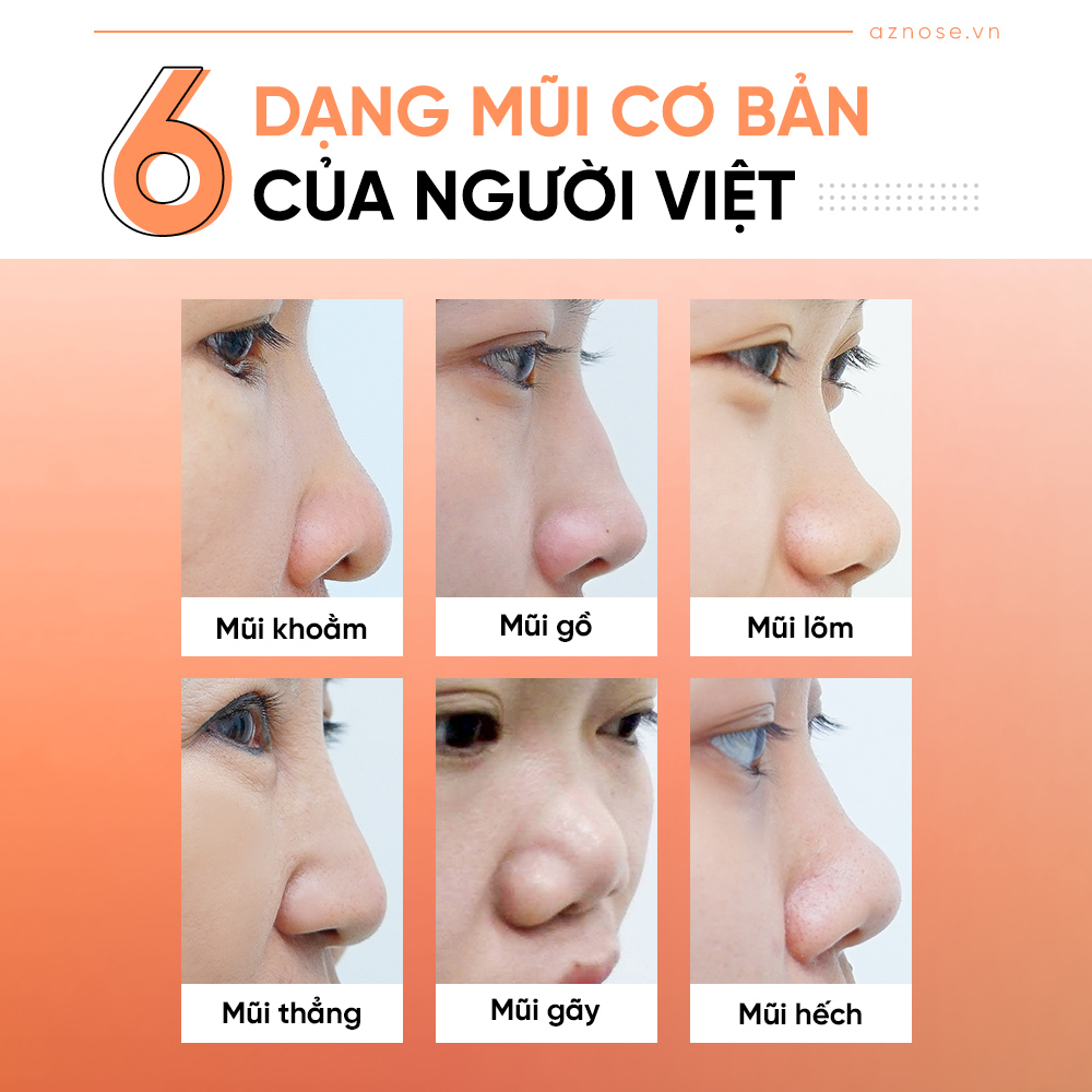 Những dáng mũi cơ bản của người Á Đông nói chung và người Việt nói riêng.