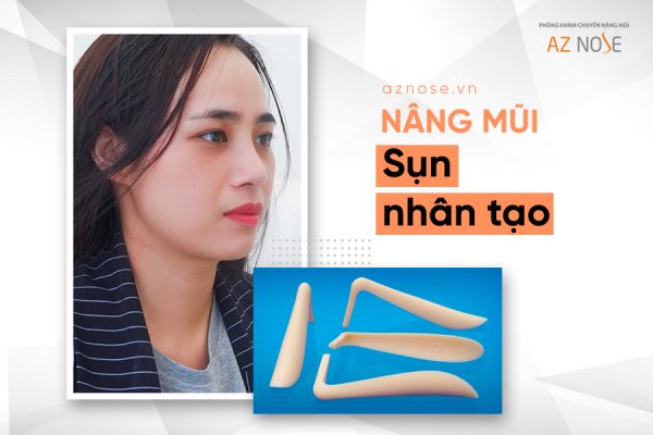 Phương pháp nâng mũi bằng sụn nhân tạo là gì ?
