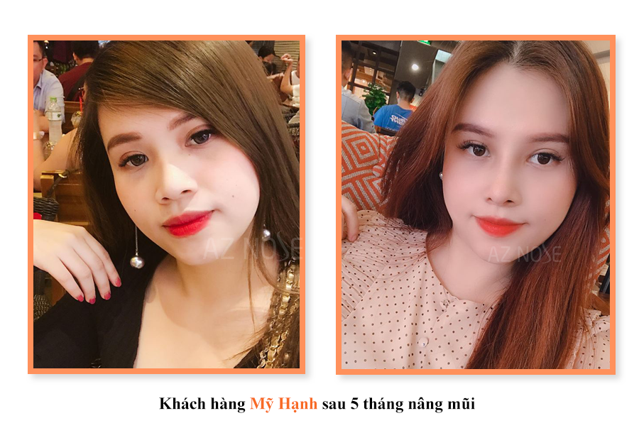 Phụ nữ thế hệ 9x: Ai thấu nỗi đau này?