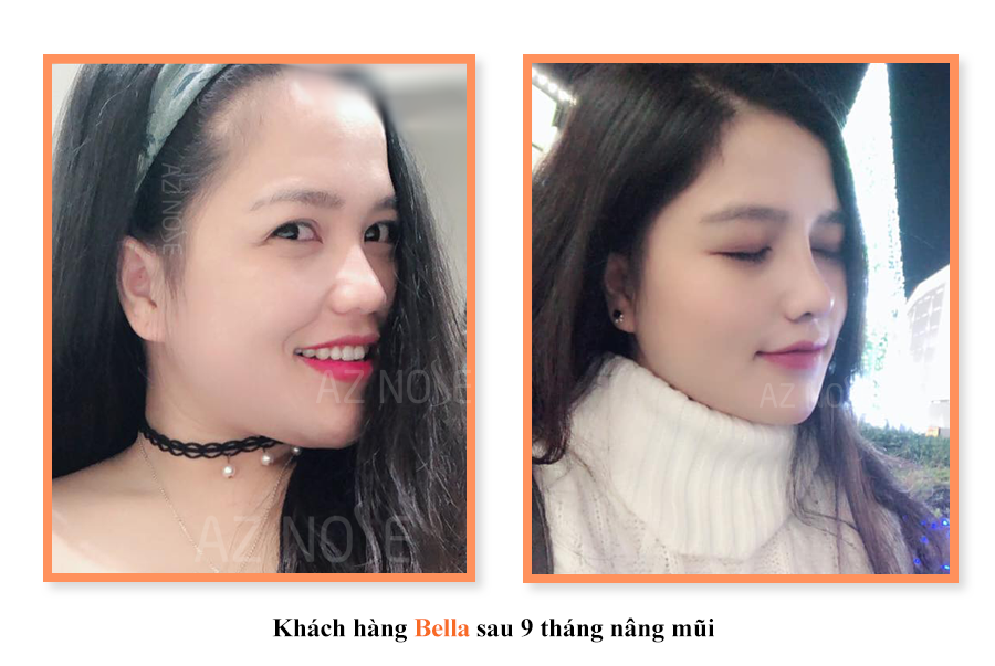 Phụ nữ thế hệ 9x: Ai thấu nỗi đau này?