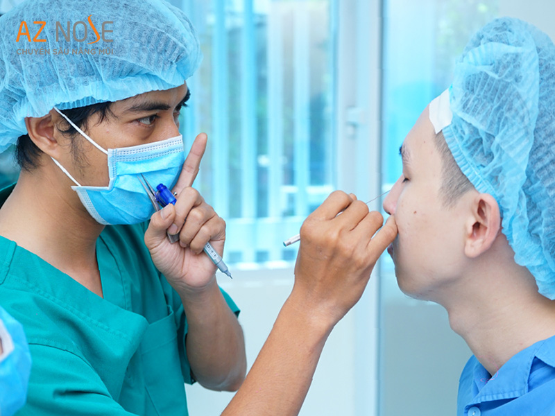 Bác sĩ chuyên môn cao có nhiều năm kinh nghiệm tại AZ NOSE - Chuyên sâu nâng mũi.