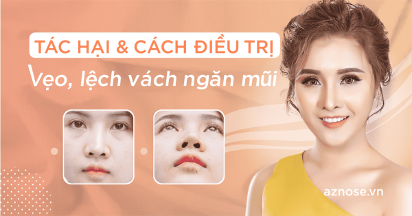Lệch Vách Ngăn Mũi: Nguyên Nhân, Tác Hại Và Cách Điều Trị