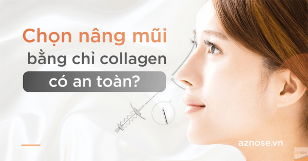 Chọn nâng mũi bằng chỉ collagen có an toàn không ? Hậu quả & biến chứng khi lựa nâng mũi chỉ