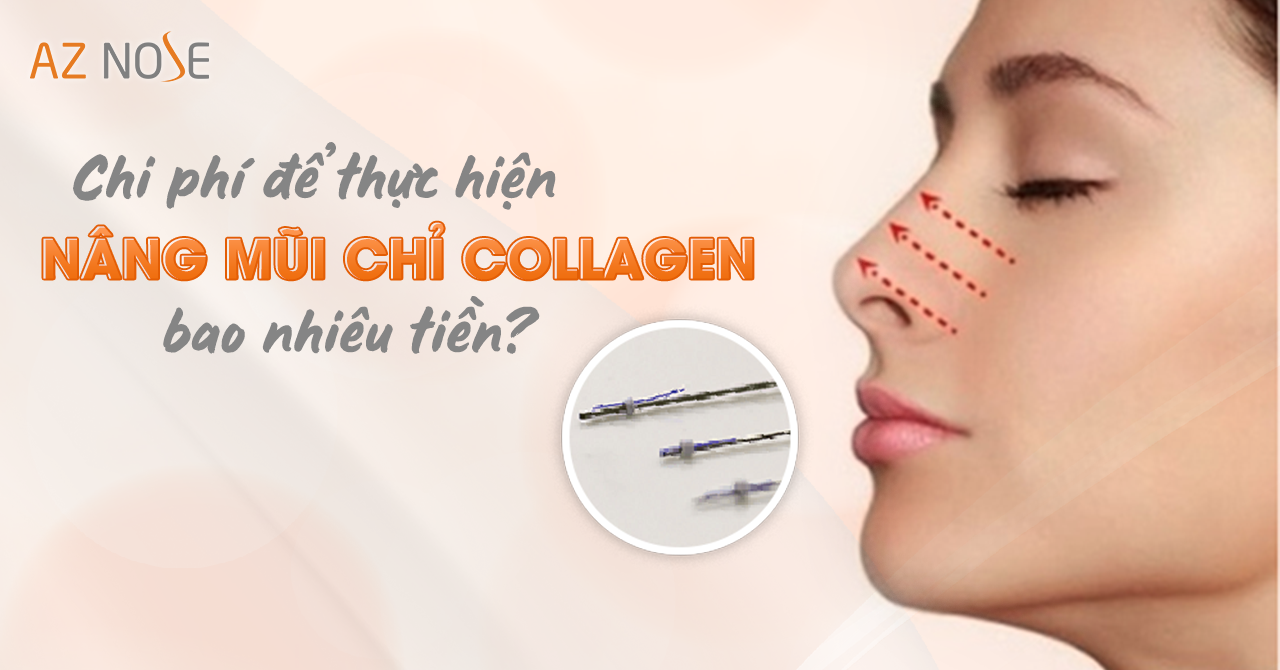Nâng mũi chỉ collagen tốn chi phí bao nhiêu?