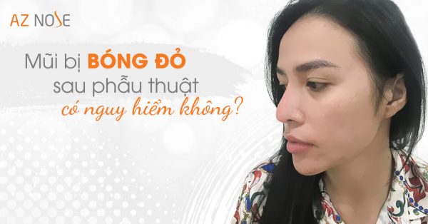 Mũi bị bóng đỏ lên sau phẫu thuật nâng mũi có nguy hiểm không?