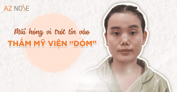 Điều trị mũi hỏng cho những khách hàng trót tin Thẩm mỹ viện "dỏm"