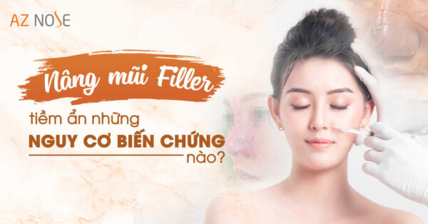 Nâng mũi tiêm filler tiềm ẩn những biến chứng nguy hiểm nào?