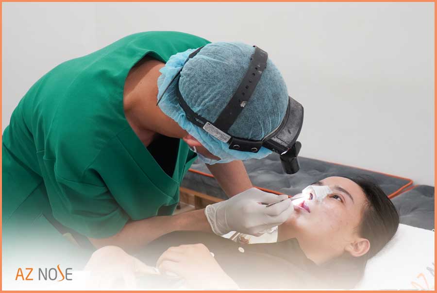 Cải thiện dáng mũi to với phương pháp nâng mũi độc quyền tại AZ NOSE