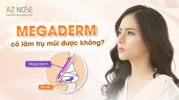 Dựng trụ mũi bằng Megaderm được không?