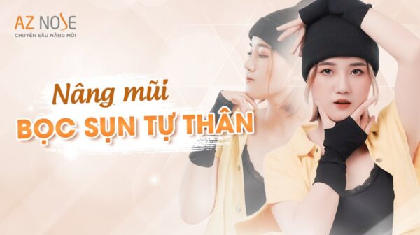 Nâng mũi bọc sụn tự thân đầu mũi: 4 lưu ý phải đọc từ chuyên gia