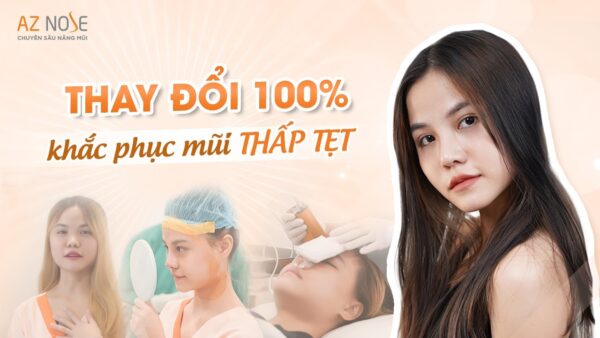 "Chia Tay" Dáng Mũi Thấp Tẹt Với Phương Pháp Nâng Mũi Từ AZ NOSE