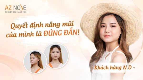 Hanh trinh ngoc dung nang mui aznose (3)