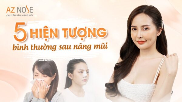 5 hiện tượng bình thường sau khi nâng mũi