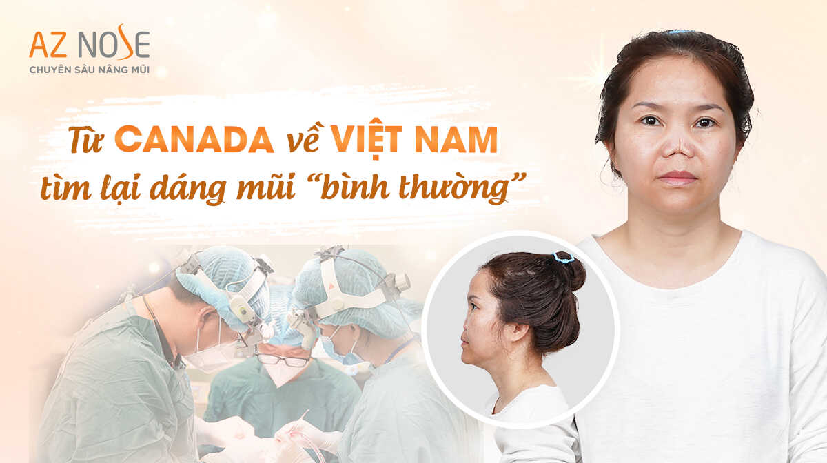 Từ Canada về Việt Nam tìm lại dáng mũi bình thường