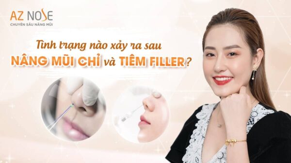 3 tình trạng thường gặp sau nâng mũi cấy chỉ và tiêm filler
