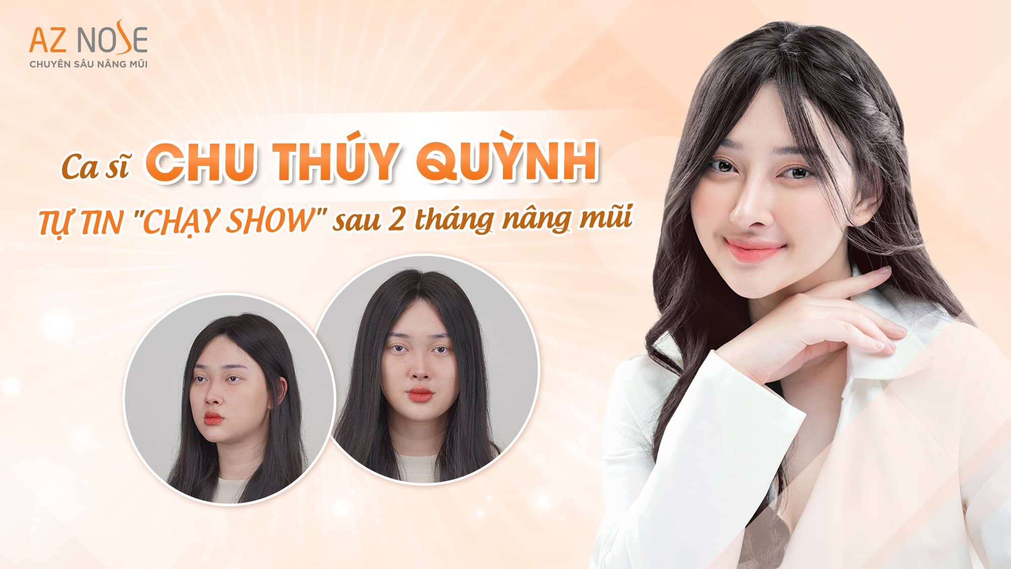 Ca sĩ Chu Thúy Quỳnh tự tin chạy show sau 2 tháng nâng mũi