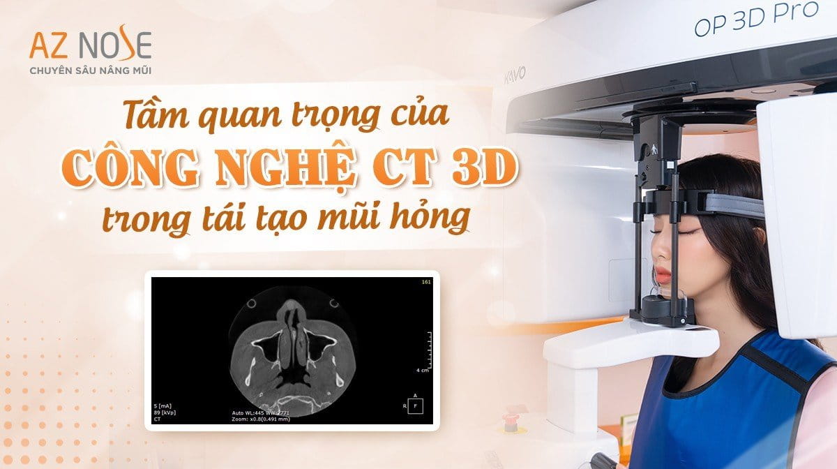 Tầm quan trọng của công nghệ CT 3D trong việc tái tạo mũi hỏng