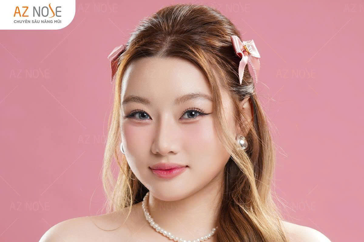 Thế nào là dáng mũi tự nhiên? Khách hàng Gia Hân - Á hậu Biển 2024 sau 4 tháng nâng mũi tại Phòng khám AZ NOSE
