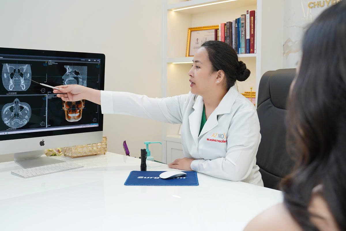 4 trường hợp thường được bác sĩ chỉ định nâng mũi cấu trúc