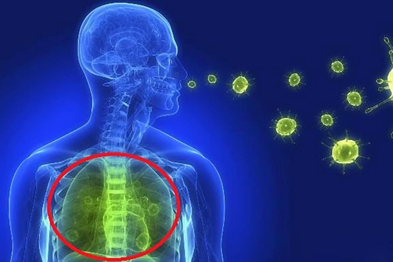 Cúm A có nguy cơ lây lan thông qua các giọt bắn