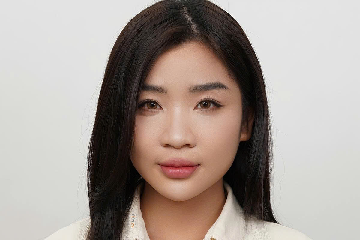 Top 20 Miss Grand Vietnam 2025 Tường Vi sau 1 năm nâng mũi cấu trúc tại AZ NOSE