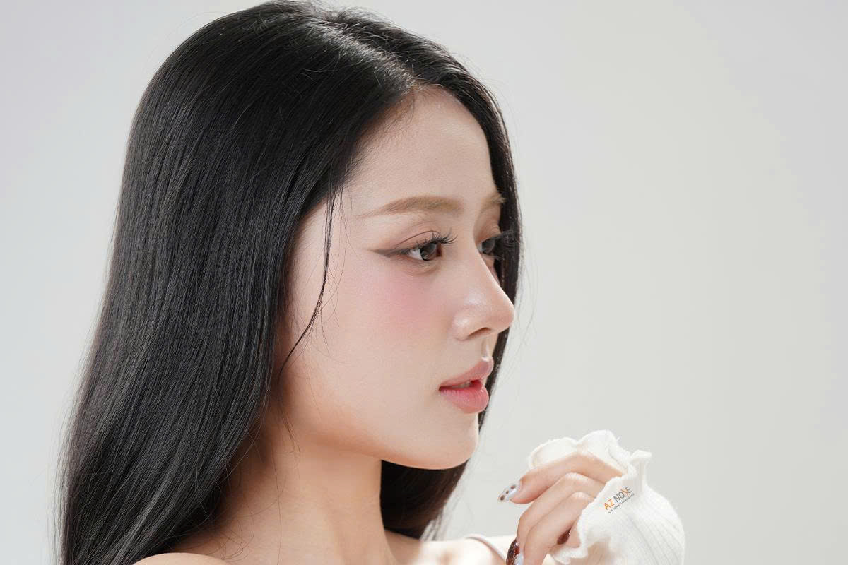 Chị T.Th. sau 3 tháng nâng mũi cấu trúc tại Phòng khám thẩm mỹ AZ NOSE